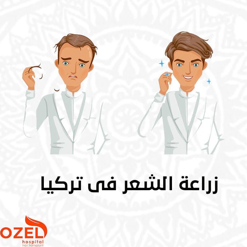 أفضل مراكز زراعة الشعر في تركيا M