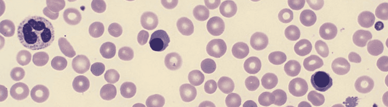 الكريات_الحمراء_المنواه__NRBC__nucleated_red_blood_cells-2