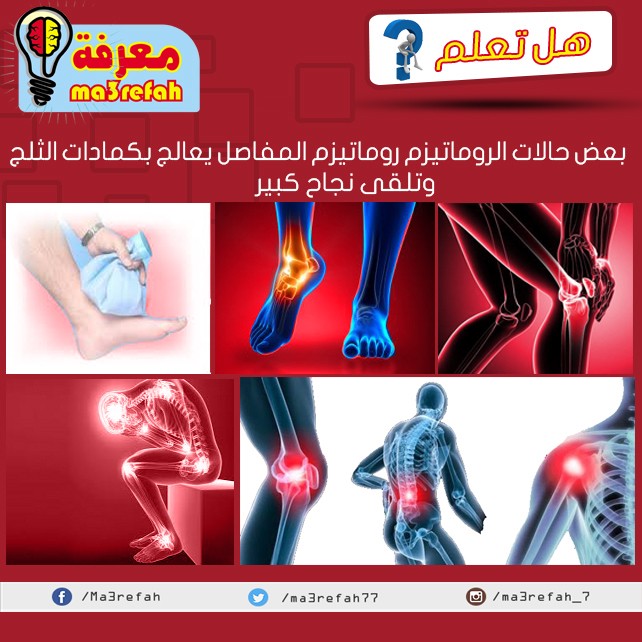 3_روماتيزم