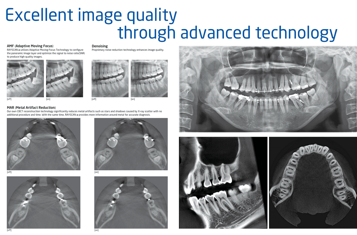 RAYSCAN-alpha_Brochure_a01_EN-5