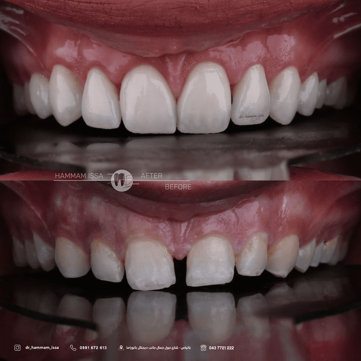 مركز الدكتور همّام للأسنان