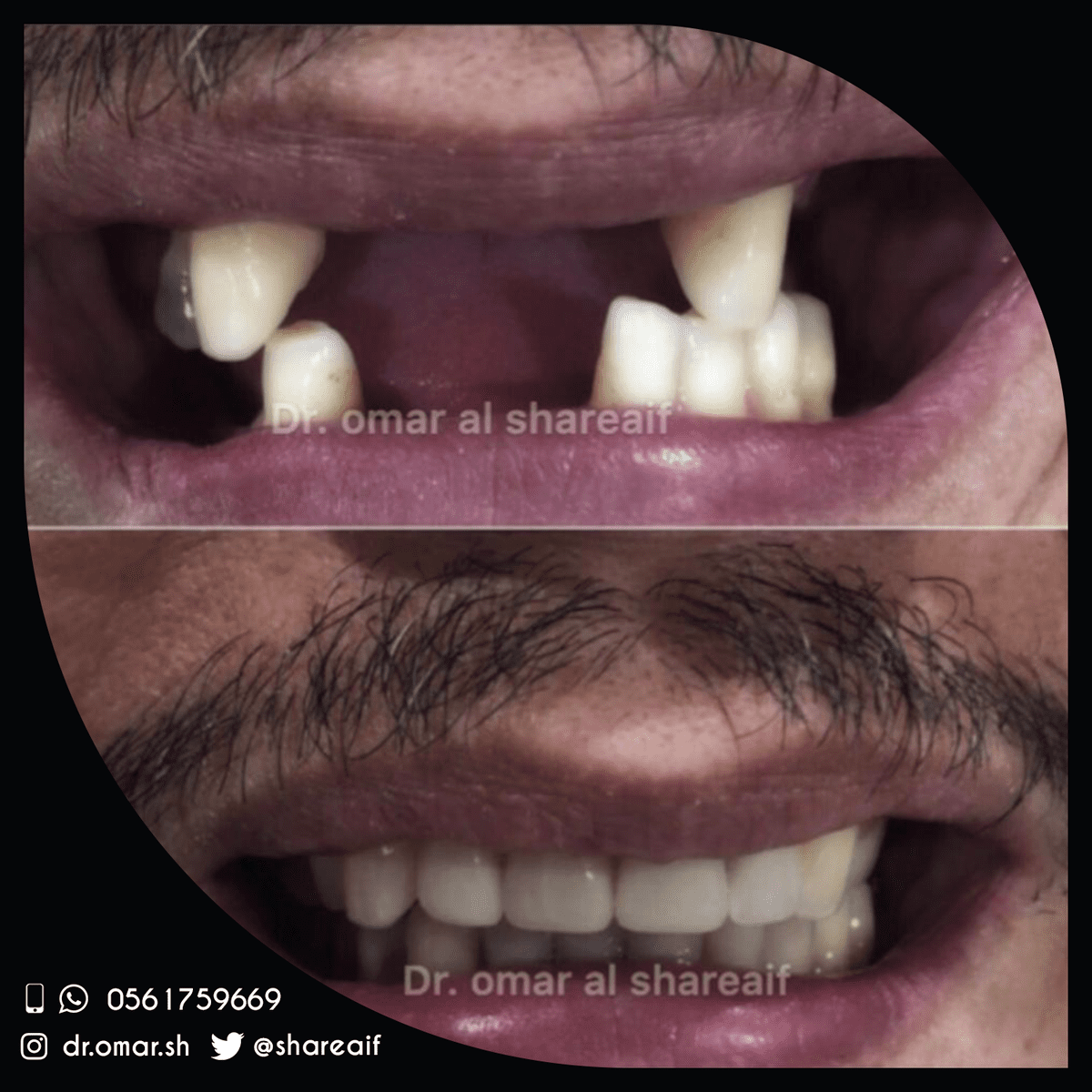 1-dentiste