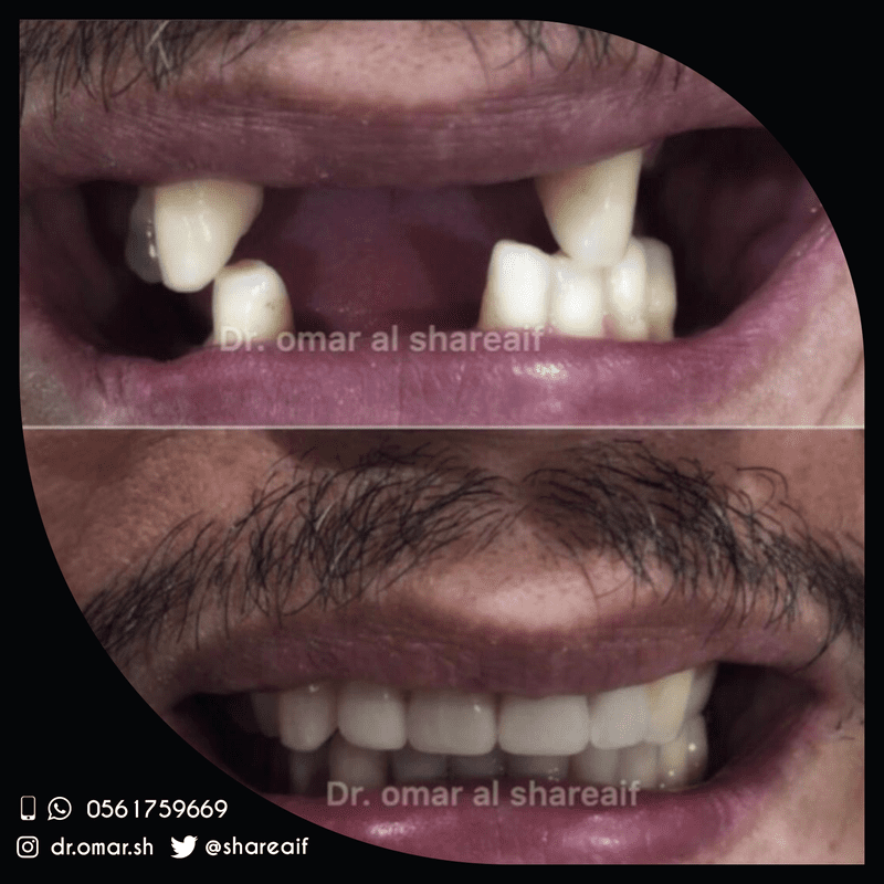 1-dentiste