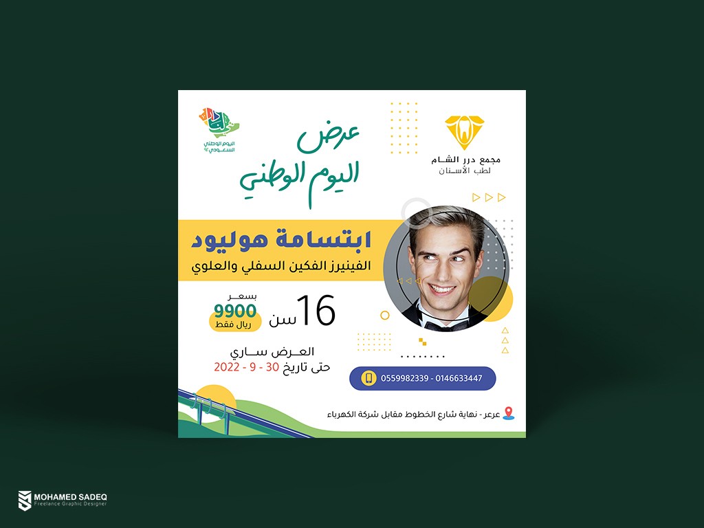 ابتسامة هوليود