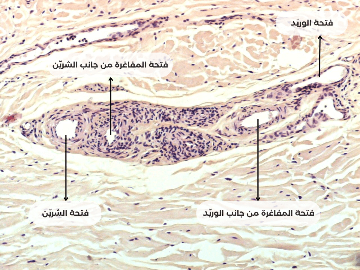 فتحة_الشريّن