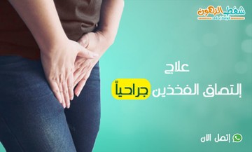 علاج التصاق الفخذين جراحيا مع أفضل دكتور وسعر العملية S