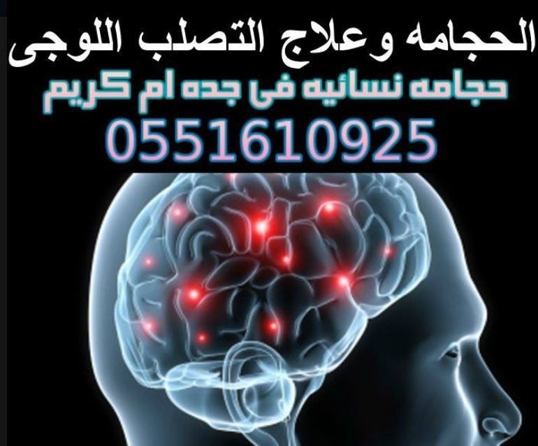 الحجامه_وعلاج_التصلب_الوجى