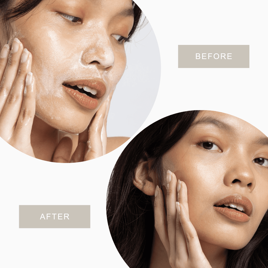 العنايه بالبشره