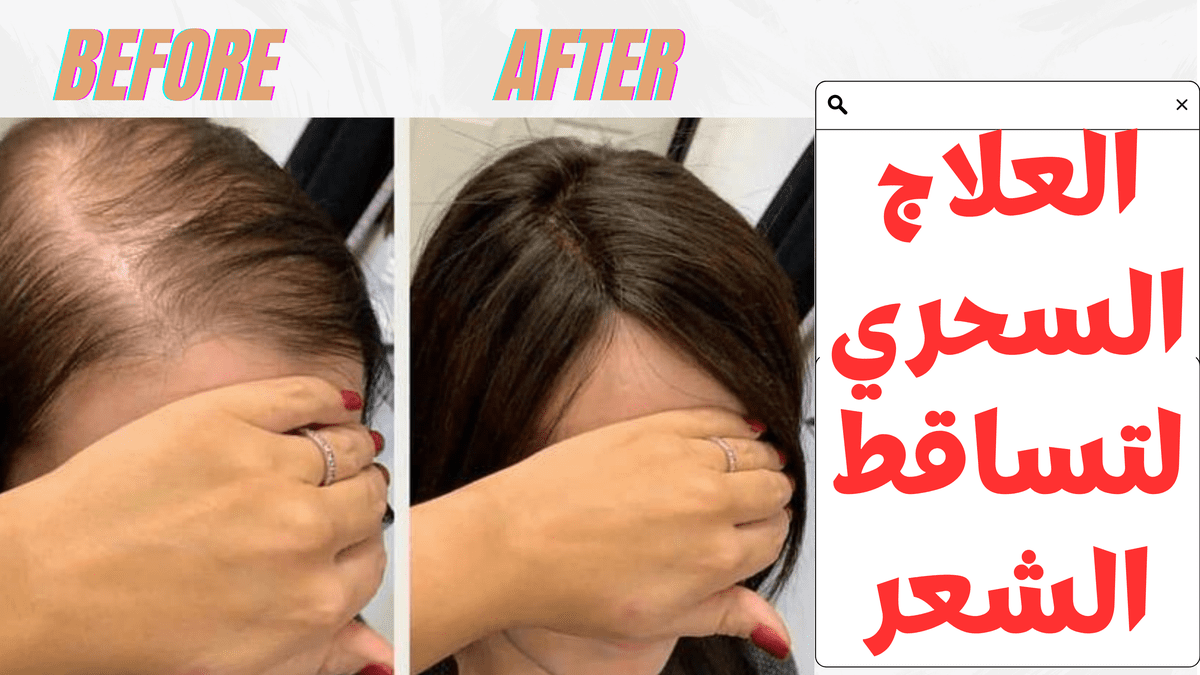 صورة مصغرة لفيديو عن التساقط