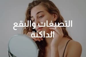 التصبغات والبقع الداكنة