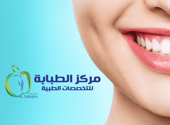 عملية استبدال حشوات الأسنان التقليدية M