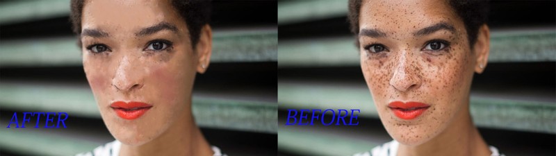 dark-spot-on-face-1024x5761