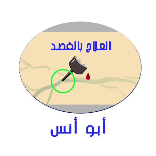 ابو انس لعلاج عرق النسا بالفصد فى الرياض 0557044912 L