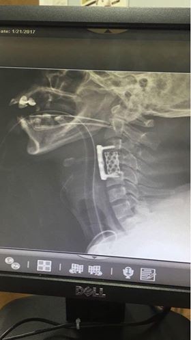 20180602-1844-n3cbqz