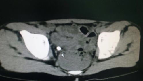 20180120-17559-1gpjmb7