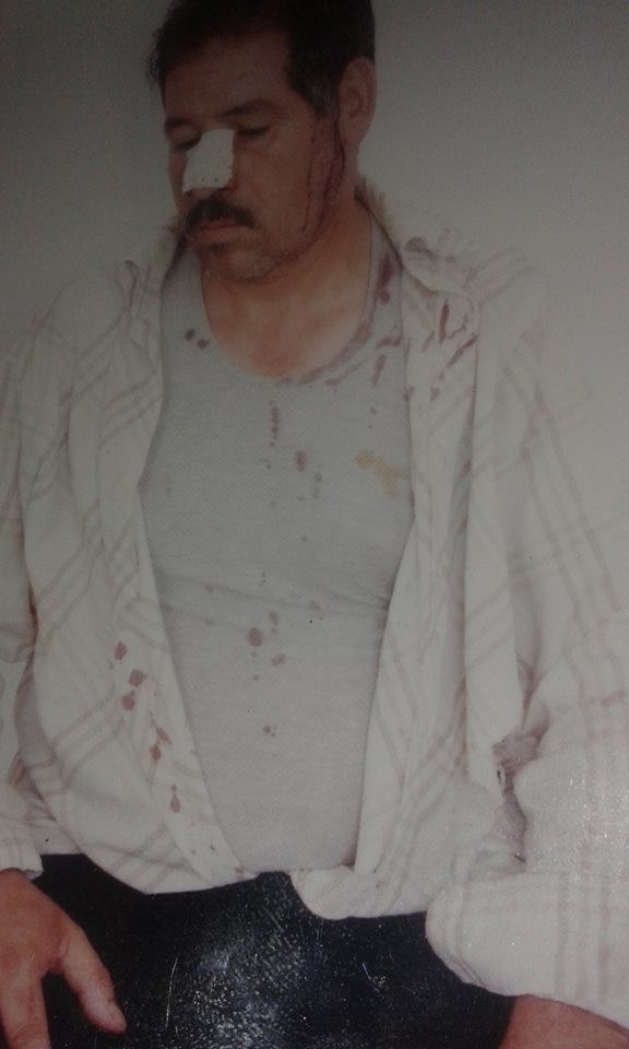  تم اعتيدء سفير من طراف محمد خطير/ ش/ واخه يوسف واعوانهم بي واسيطة سيلاح الابيض بي مدينة خنيفرة