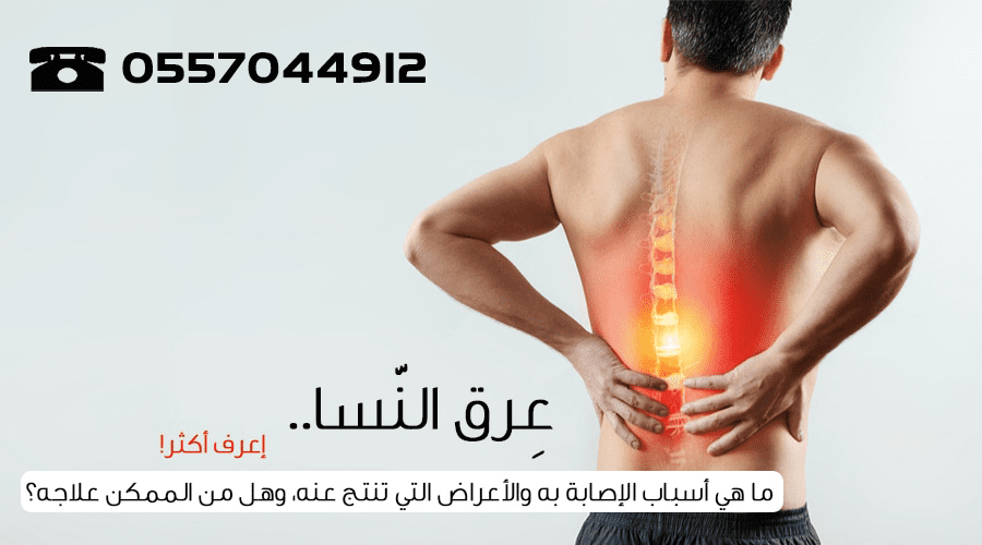 الرياض - ابو انس لعلاج عرق النسا بالفصد فى الرياض 0557044912 L