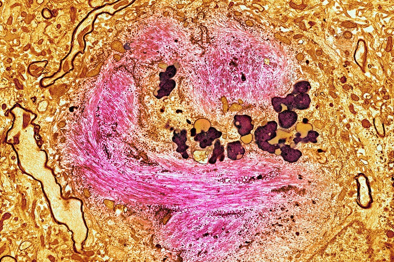 20160729-2888-15cv3lo