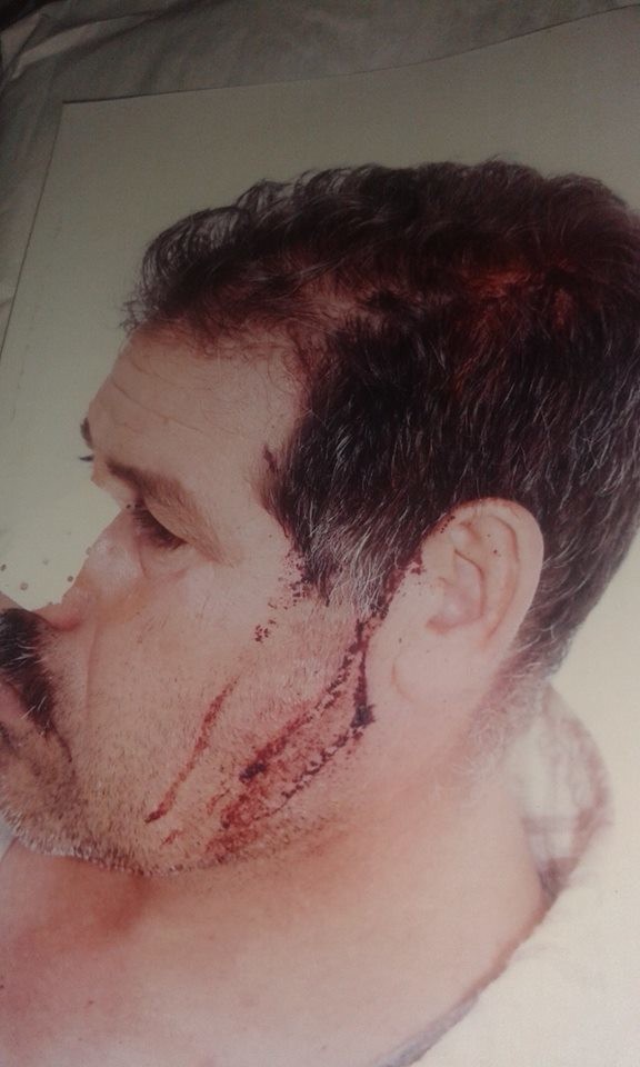  تم اعتيدء سفير من طراف محمد خطير/ ش/ واخه يوسف واعوانهم بي واسيطة سيلاح الابيض بي مدينة خنيفرة