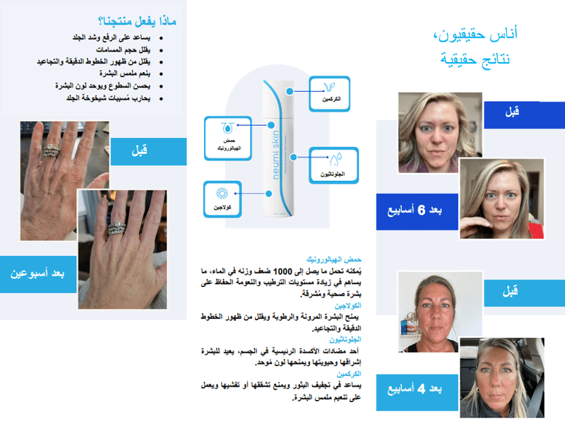 الحصول بشرة صحية نيومي نتريسويش: