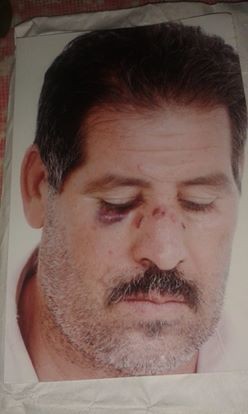  تم اعتيدء سفير من طراف محمد خطير/ ش/ واخه يوسف واعوانهم بي واسيطة سيلاح الابيض بي مدينة خنيفرة