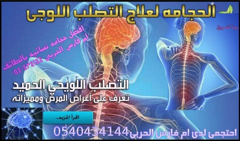 الحجامه_وعلاج_التصلب_الوجى2ط